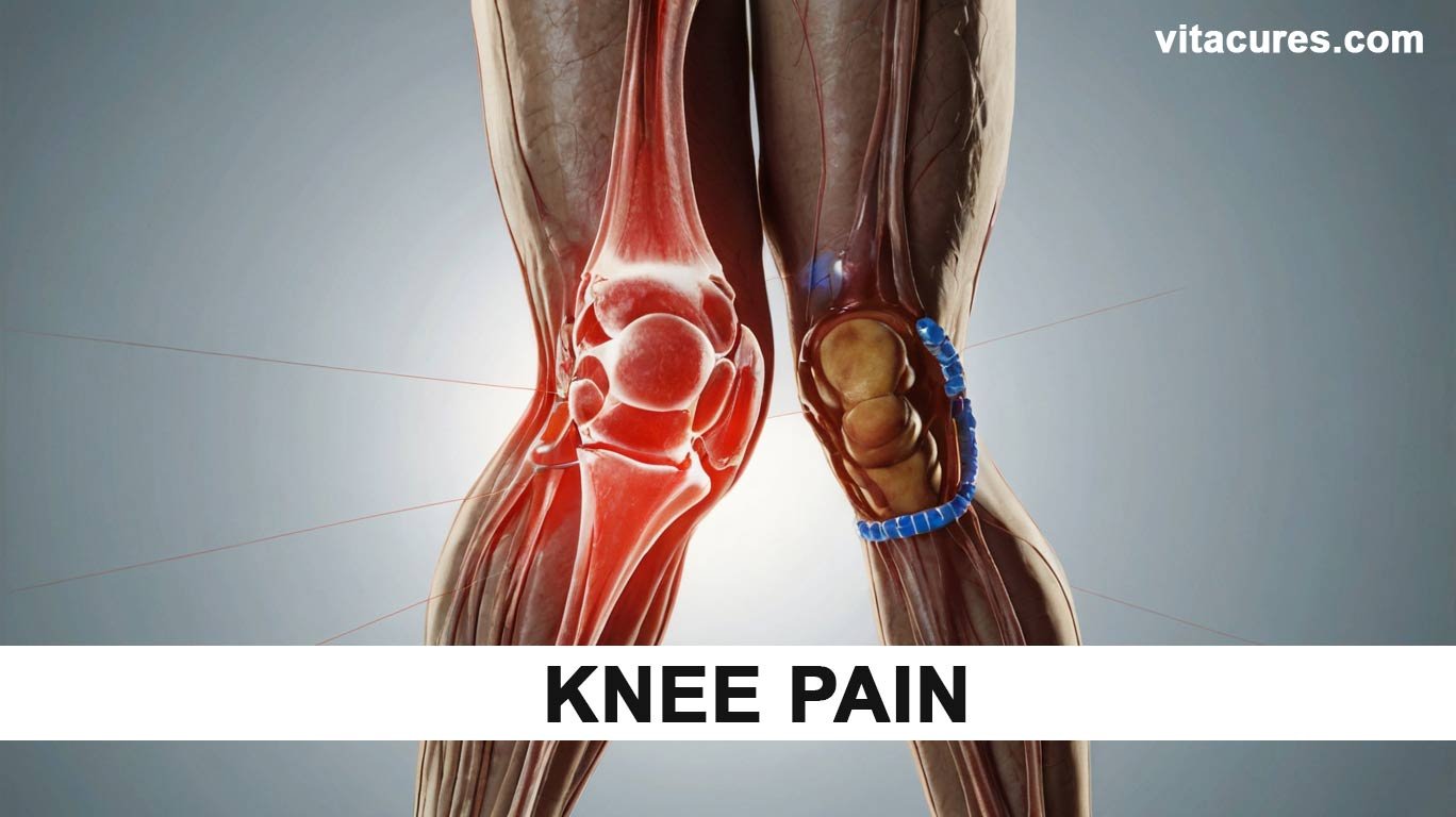 Knee-Pain