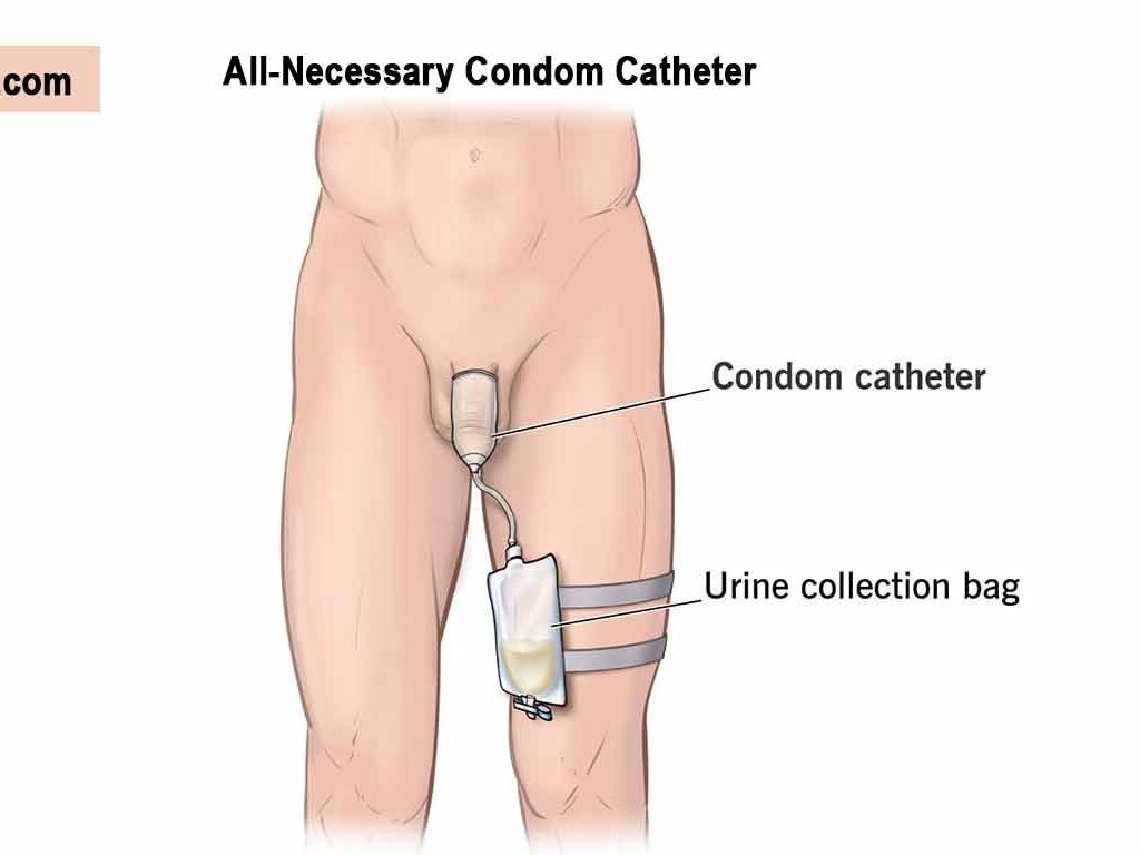 Condom-Catheter