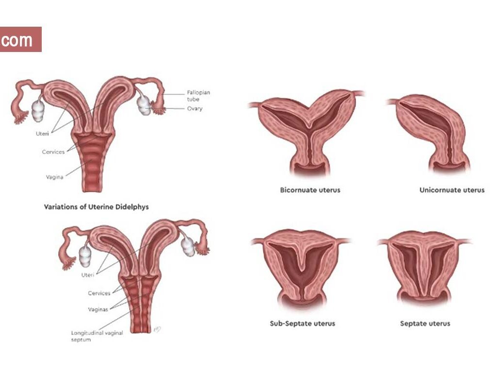 Vaginal septum