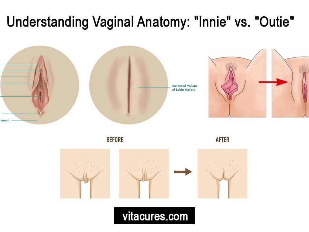 Innie-vaginas