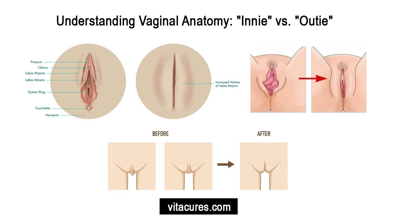 Innie-vaginas