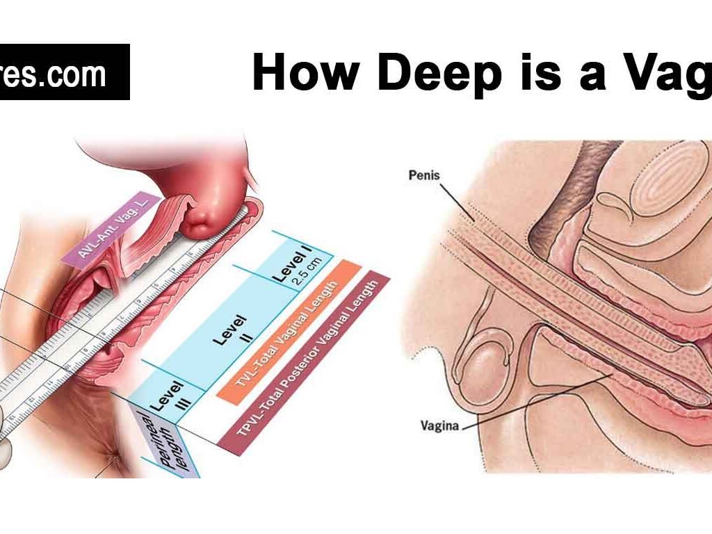 Vaginal depth