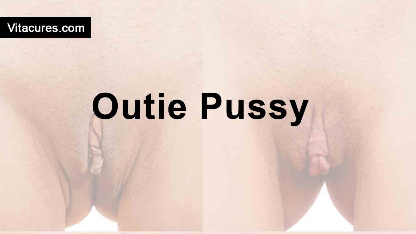 Outie Pussy