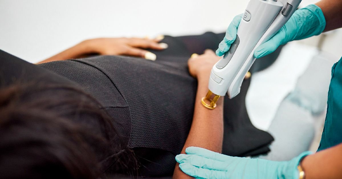 Eczema Laser
