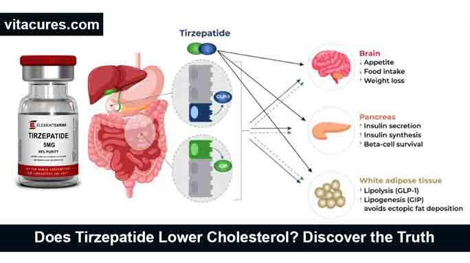 Tirzepatide Lower Cholesterol