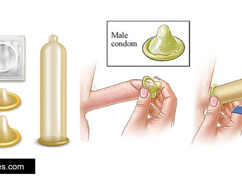 Condom
