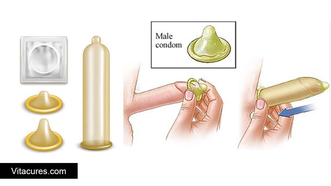 Condom