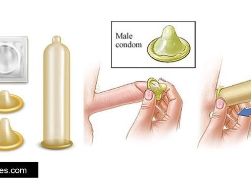 Condom